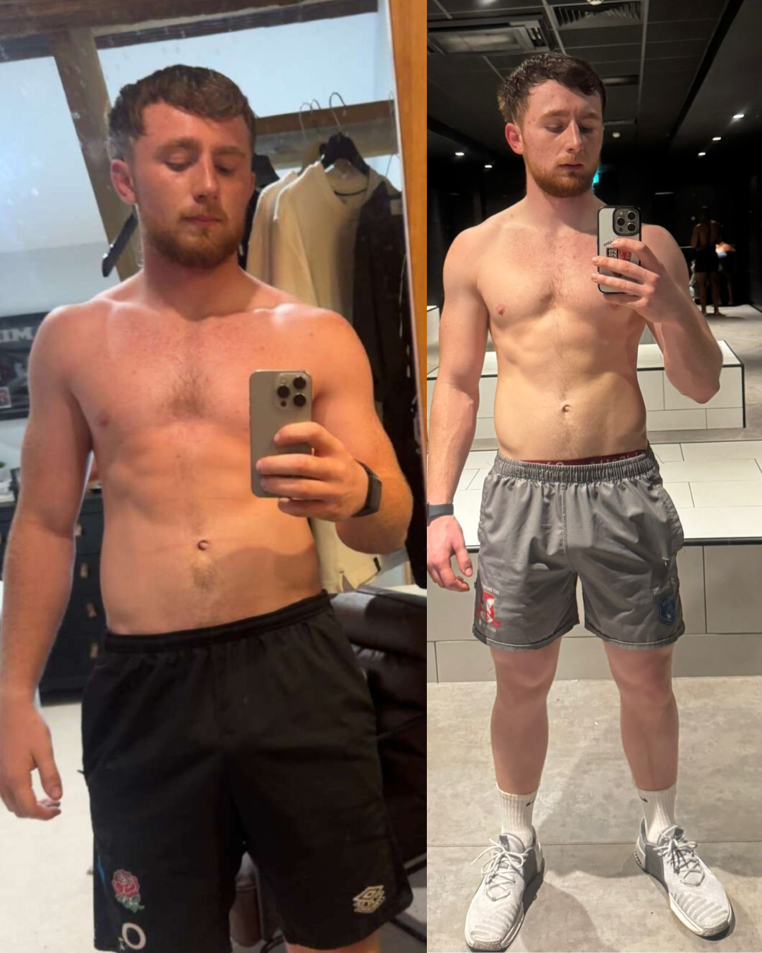 Fyn transformation